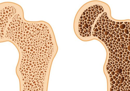 Sụn, khớp và lão hóa: Những điều bạn cần biết