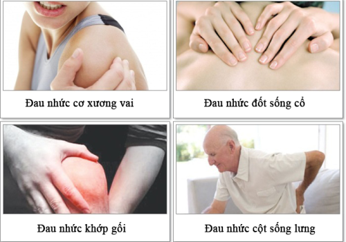 4 NGHỀ NGHIỆP DỄ BỊ BỆNH KHỚP NHẤT
