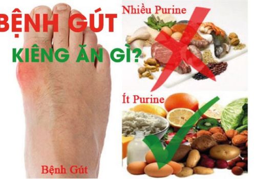 NGƯỜI MẮC BỆNH GÚT NÊN KIÊNG GÌ VÀ ĂN GÌ?