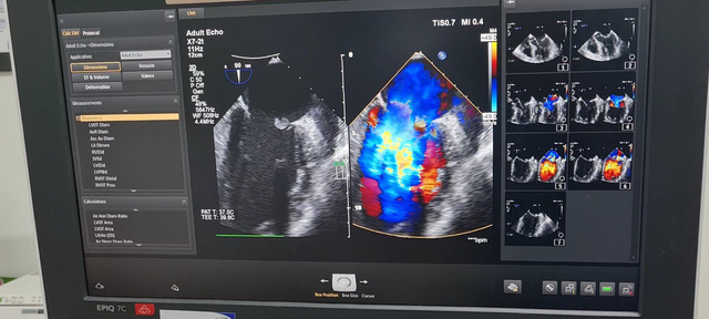 29356936227448923123144554633481892507711092n-16583972211371079106406