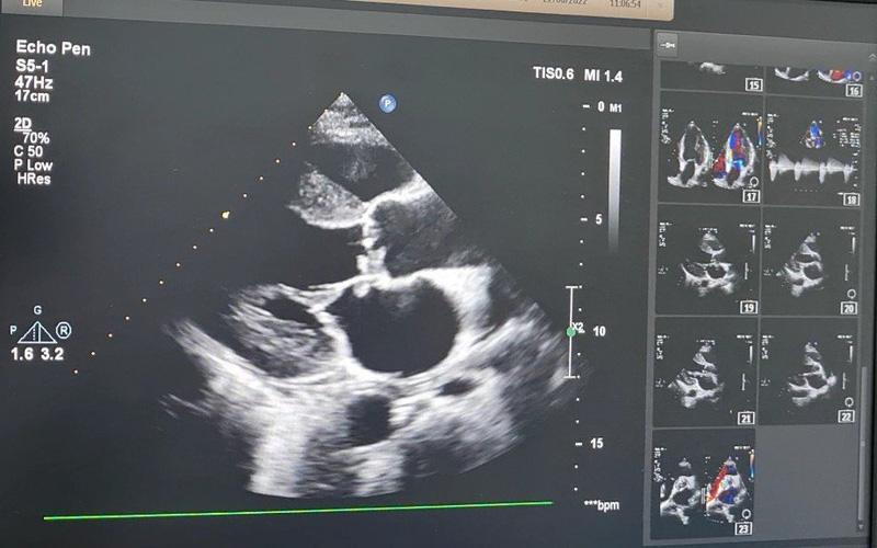 2949026192744892415647778480266861963961263n-1658397288349680147454-crop-1658397297873410347754